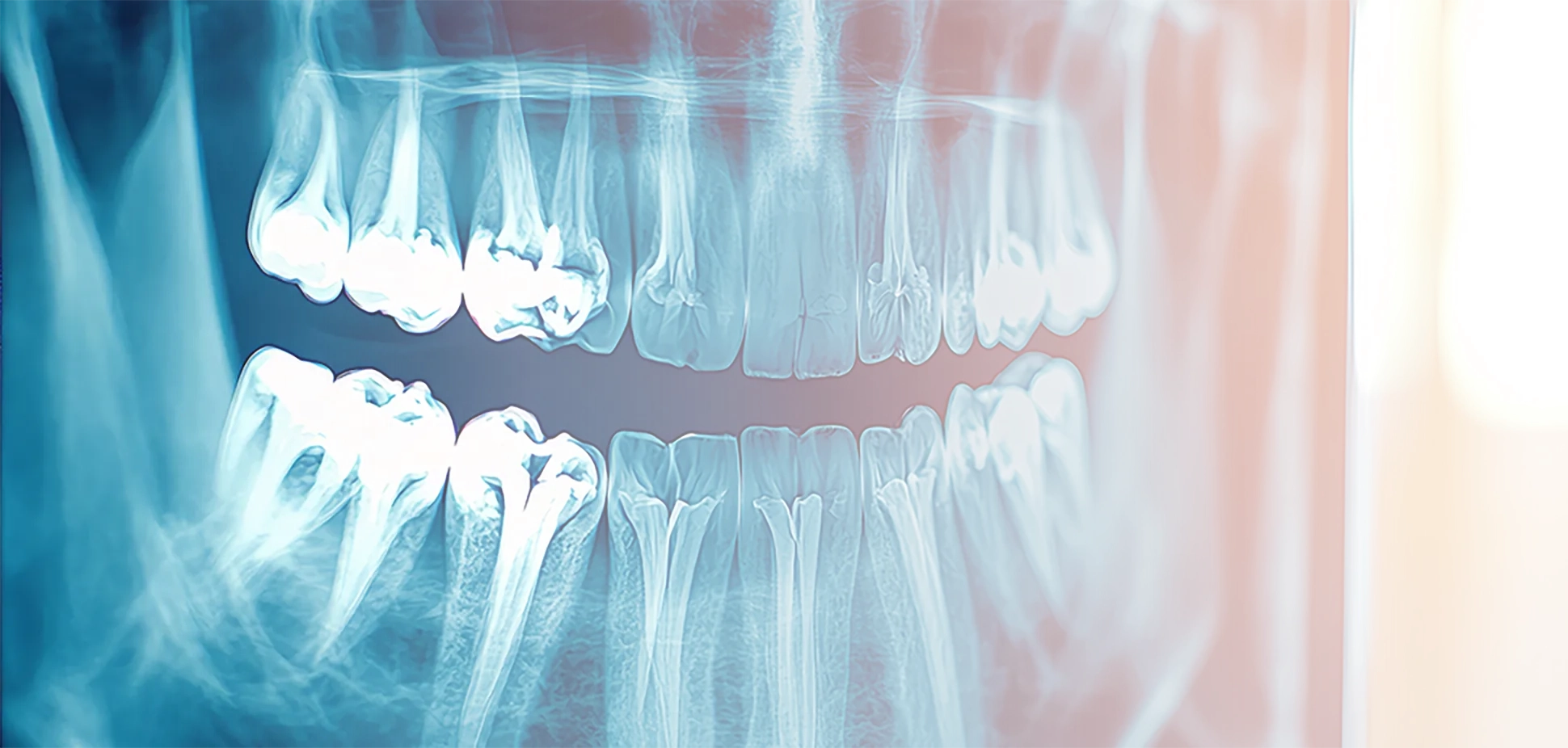 インプラントを検討する前に