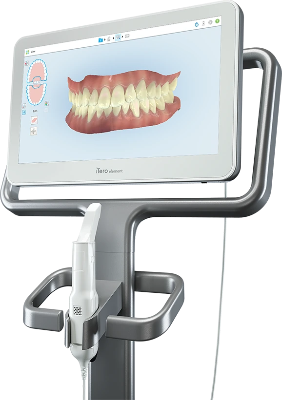 iTero