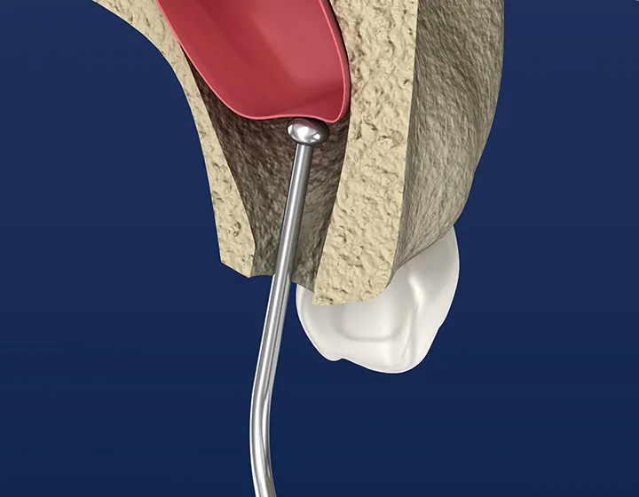 クレスタルアプローチ