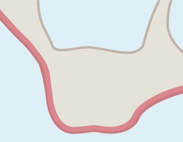 約半年後の骨の成熟