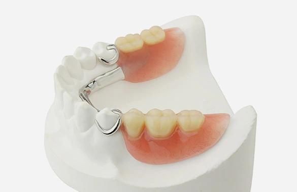 入れ歯とブリッジで悩んでいる 