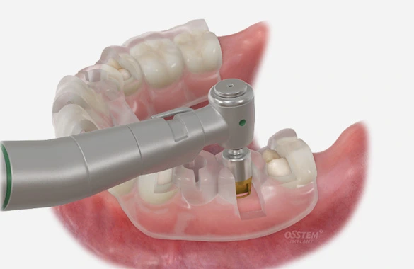 痛みや腫れが怖くて不安