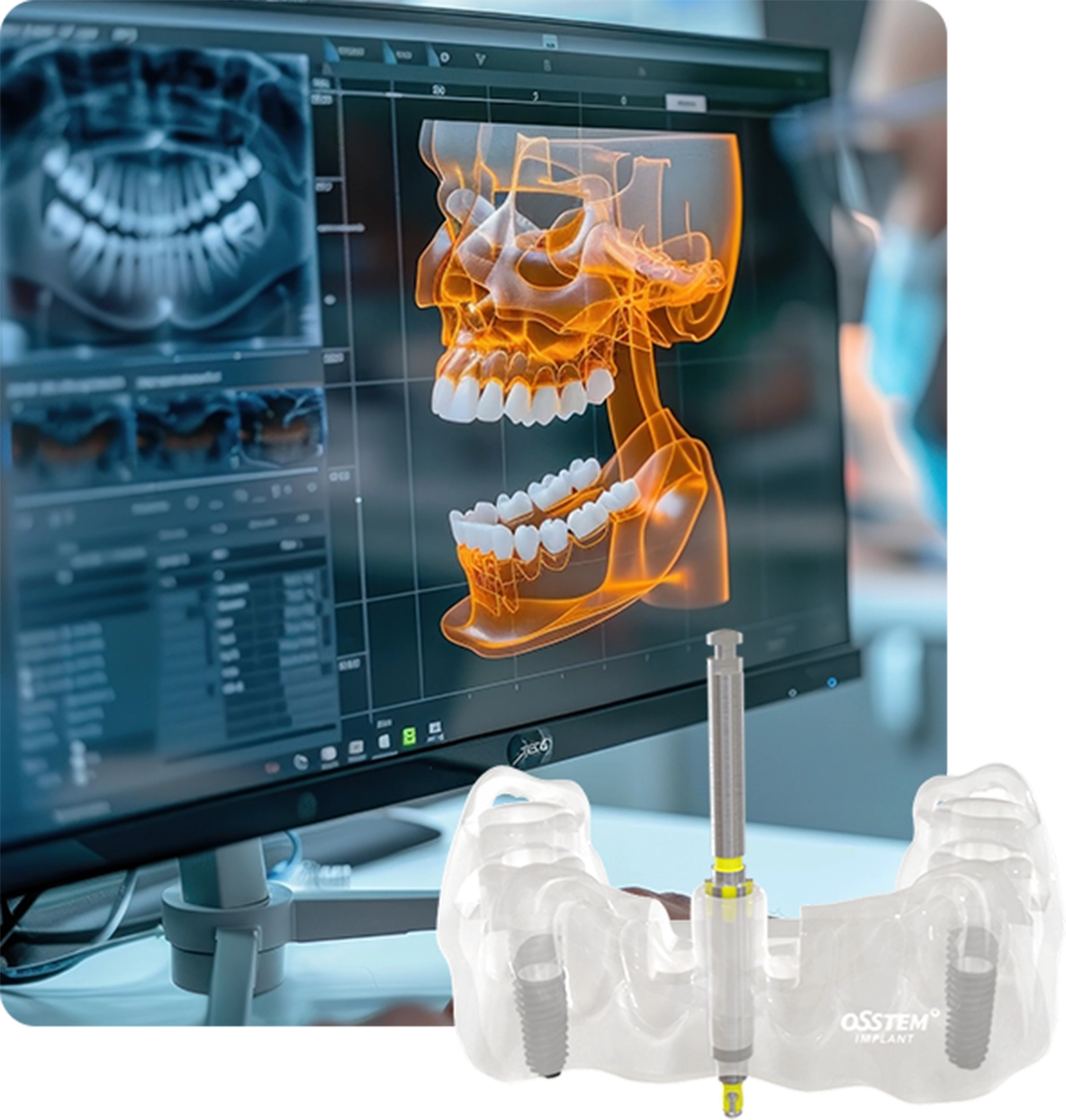 サージカルガイドとは？