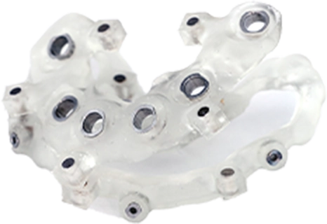 埋入位置・角度の決定