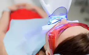 オフィスホワイトニング