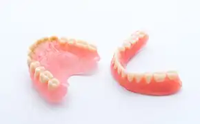 レジン床義歯