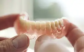 シリコンデンチャー