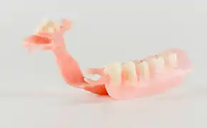 ノンクラスプデンチャー