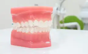 マウスピース矯正