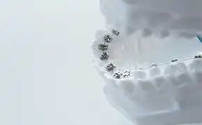 裏側矯正