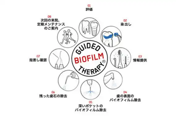 Guided Biofilm Therapy