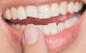 外傷